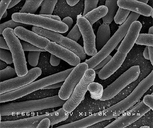 Escherichia coli: חיידק נפוץ, הכולל כמה זנים מסוכנים. תעשיית העופות היא גורם משמעותי בפיתוח חיידקים עמידים בפני...